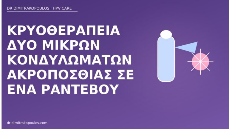 κρυοθεραπεία κονδυλώματα ακροποσθία
