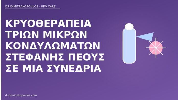 Κρυοθεραπεία τριών μικρών κονδυλωμάτων στεφάνης πέους σε μία συνεδρία κρυοθεραπεία στεφάνη πέους