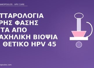 Κυτταρολογία υγρής φάσης μετά από τραχηλική βιοψία με θετικό HPV 45 κυτταρολογία μετά βιοψία HPV 45