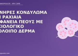 Μονήρες κονδύλωμα στη ραχιαία επιφάνεια πέους με φυσιολογικό υπόλοιπο δέρμα κονδύλωμα ραχιαία πέους