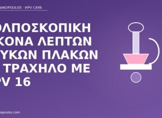 Κολποσκοπική εικόνα λεπτών λευκών πλακών σε τράχηλο με HPV 16 κολποσκόπηση λευκές πλάκες HPV16