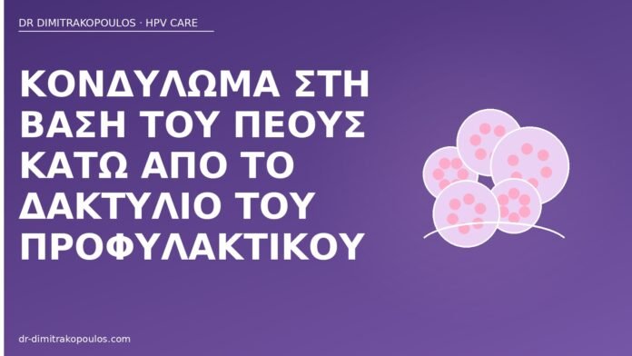 Κονδύλωμα στη βάση του πέους κάτω από το δακτύλιο του προφυλακτικού κονδύλωμα βάση πέους