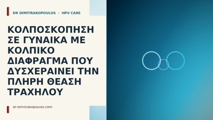 κολποσκόπηση κολπικό διάφραγμα
