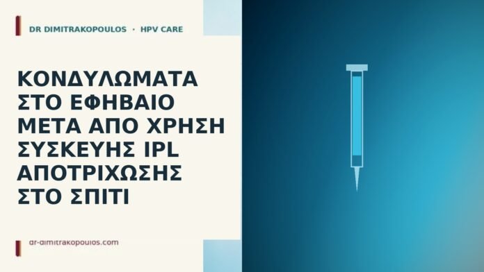 κονδυλώματα μετά IPL εφήβαιο