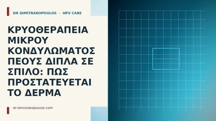 Κρυοθεραπεία μικρού κονδυλώματος πέους δίπλα σε σπίλο: πώς προστατεύεται το δέρμα κρυοθεραπεία κονδύλωμα πέους