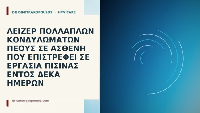 Λέιζερ πολλαπλών κονδυλωμάτων πέους σε ασθενή που επιστρέφει σε εργασία πισίνας εντός δέκα ημερών λέιζερ κονδυλώματα εργασία πισίνα