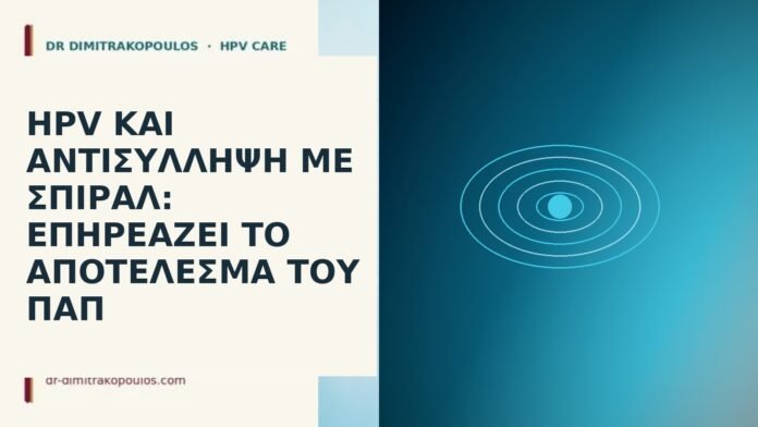 HPV και αντισύλληψη με σπιράλ: επηρεάζει το αποτέλεσμα του Παπ HPV και αντισύλληψη με σπιράλ