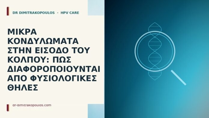 Μικρά κονδυλώματα στην είσοδο του κόλπου: πώς διαφοροποιούνται από φυσιολογικές θηλές Μικρά κονδυλώματα στην είσοδο του κόλπου