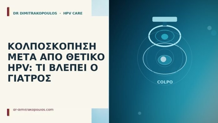 Κολποσκόπηση μετά από θετικό HPV: τι βλέπει ο γιατρός κολποσκόπηση θετικό HPV