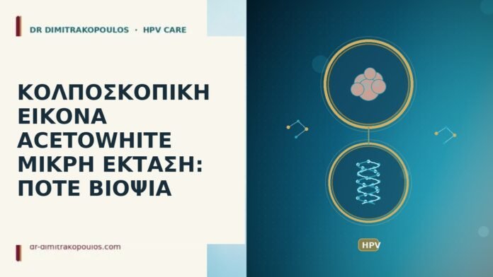 Κολποσκοπική εικόνα acetowhite μικρή έκταση: πότε βιοψία acetowhite μικρή έκταση