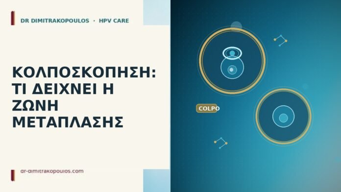 κολποσκόπηση ζώνη μετάπλασης