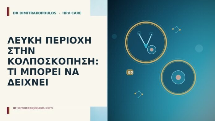 λευκή περιοχή κολποσκόπηση