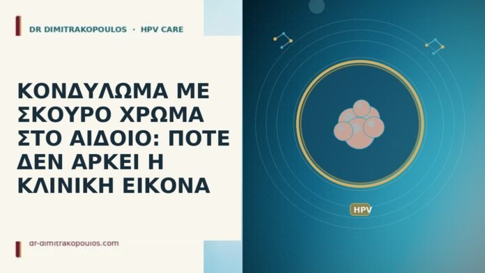 ΚΟΝΔΥΛΩΜΑ ΜΕ ΣΚΟΥΡΟ ΧΡΩΜΑ ΣΤΟ ΑΙΔΟΙΟ: ΠΟΤΕ ΔΕΝ ΑΡΚΕΙ Η ΚΛΙΝΙΚΗ ΕΙΚΟΝΑ ΚΟΝΔΥΛΩΜΑ ΜΕ ΣΚΟΥΡΟ ΧΡΩΜΑ ΣΤΟ ΑΙΔΟΙΟ: ΠΟΤΕ ΔΕΝ ΑΡΚΕΙ Η