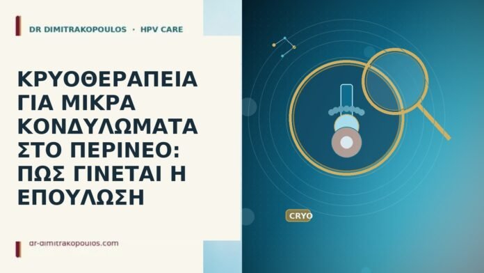 ΚΡΥΟΘΕΡΑΠΕΙΑ ΓΙΑ ΜΙΚΡΑ ΚΟΝΔΥΛΩΜΑΤΑ ΣΤΟ ΠΕΡΙΝΕΟ: ΠΩΣ ΓΙΝΕΤΑΙ Η ΕΠΟΥΛΩΣΗ
