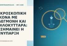 ΜΙΚΡΟΣΚΟΠΙΚΗ ΕΙΚΟΝΑ ΜΕ ΦΛΕΓΜΟΝΗ ΚΑΙ ΚΟΙΛΟΚΥΤΤΑΡΑ: ΤΙ ΣΗΜΑΙΝΕΙ Η ΣΥΝΥΠΑΡΞΗ ΜΙΚΡΟΣΚΟΠΙΚΗ ΕΙΚΟΝΑ ΜΕ ΦΛΕΓΜΟΝΗ ΚΑΙ ΚΟΙΛΟΚΥΤΤΑΡΑ: ΤΙ ΣΗΜΑΙΝΕΙ Η ΣΥΝΥΠΑΡΞΗ