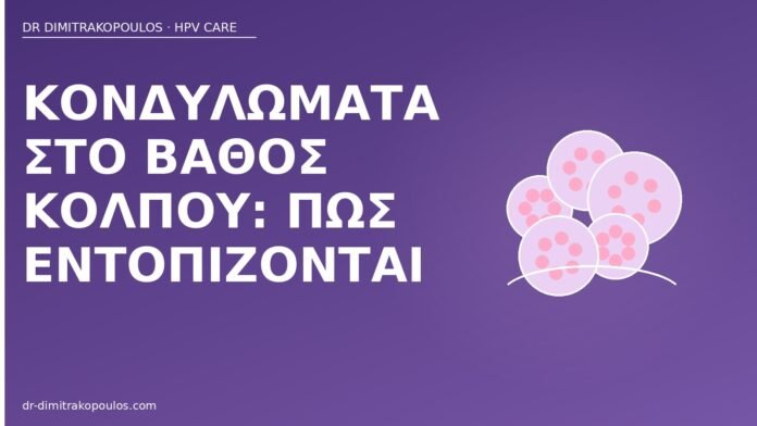 Κονδυλώματα στο βάθος κόλπου: πώς εντοπίζονται κονδυλώματα βάθος κόλπου