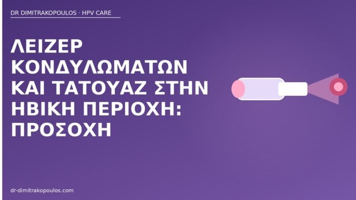 λέιζερ κονδυλωμάτων τατουάζ ηβική