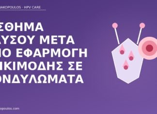 Αίσθημα καύσου μετά από εφαρμογή ιμικιμόδης σε κονδυλώματα καύσος ιμικιμόδη κονδυλώματα