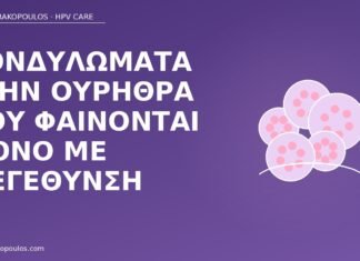 Κονδυλώματα στην ουρήθρα που φαίνονται μόνο με μεγέθυνση κονδυλώματα ουρήθρα μεγέθυνση