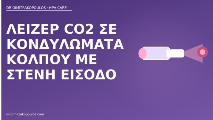 Λέιζερ CO2 σε κονδυλώματα κόλπου με στενή είσοδο λέιζερ CO2 κονδυλώματα κόλπος