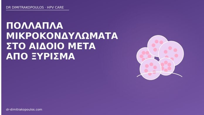 μικροκονδυλώματα αιδοίο ξύρισμα