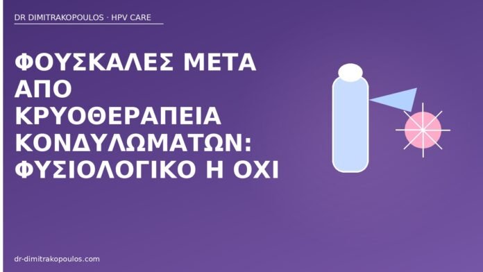 Φουσκάλες μετά από κρυοθεραπεία κονδυλωμάτων: φυσιολογικό ή όχι φουσκάλες μετά κρυοθεραπεία