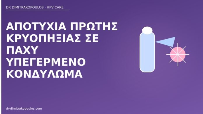 Αποτυχία πρώτης κρυοπηξίας σε παχύ υπεγερμένο κονδύλωμα αποτυχία κρυοπηξίας παχύ κονδύλωμα