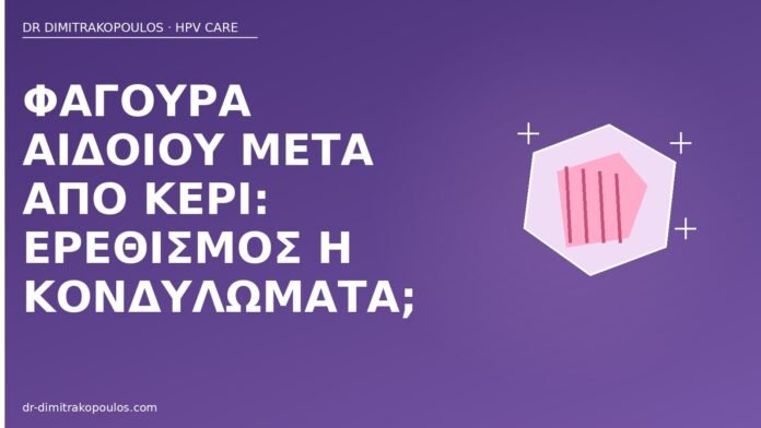 Φαγούρα αιδοίου μετά από κερί: ερεθισμός ή κονδυλώματα; φαγούρα αιδοίου κερί κονδυλώματα