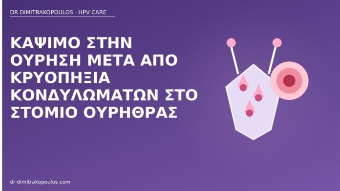 Κάψιμο στην ούρηση μετά από κρυοπηξία κονδυλωμάτων στο στόμιο ουρήθρας κάψιμο ούρηση κρυοπηξία ουρήθρα