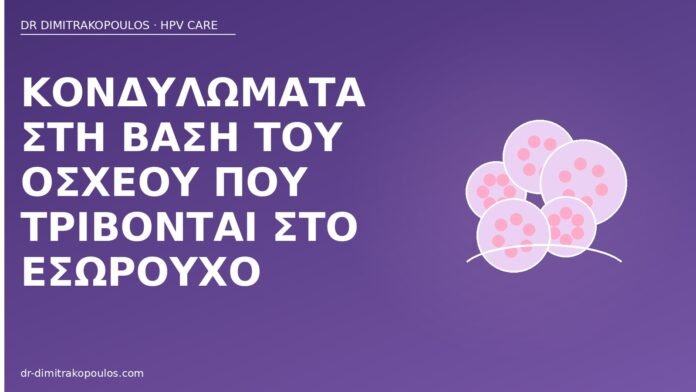 Κονδυλώματα στη βάση του οσχέου που τρίβονται στο εσώρουχο κονδυλώματα βάση οσχέου