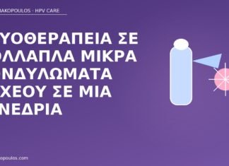 κρυοθεραπεία πολλαπλά κονδυλώματα οσχέου