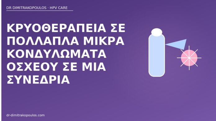 κρυοθεραπεία πολλαπλά κονδυλώματα οσχέου