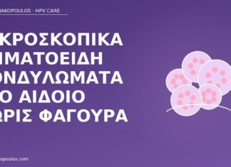 νηματοειδή κονδυλώματα αιδοίο
