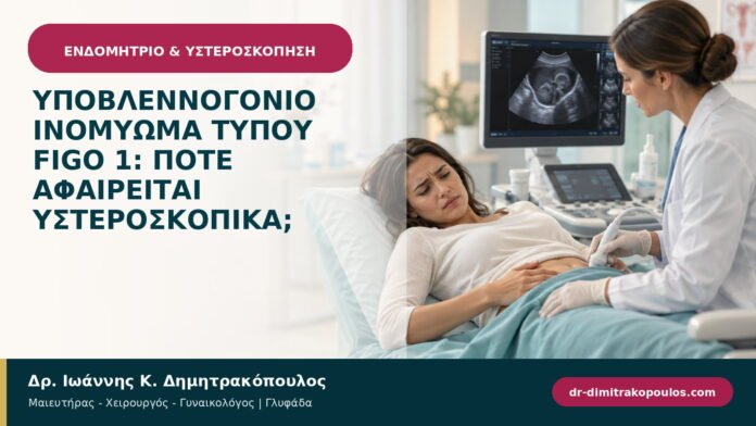 Υποβλεννογόνιο ινομύωμα τύπου FIGO 1: πότε αφαιρείται υστεροσκοπικά; Υποβλεννογόνιο ινομύωμα τύπου FIGO 1: πότε αφαιρείται υστεροσκοπικά;