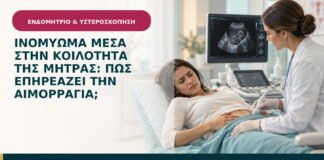 Ινομύωμα μέσα στην κοιλότητα της μήτρας: πώς επηρεάζει την αιμορραγία;