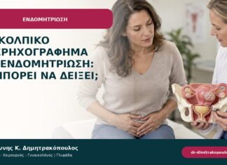 Διακολπικό υπερηχογράφημα για ενδομητρίωση: τι μπορεί να δείξει; Διακολπικό υπερηχογράφημα για ενδομητρίωση: τι μπορεί να δείξει;