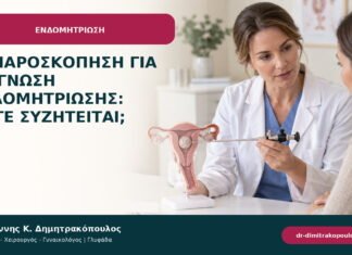 Λαπαροσκόπηση για διάγνωση ενδομητρίωσης: πότε συζητείται;