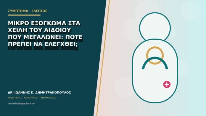 gynaikologika-symptomata-b79-26 Μικρό εξόγκωμα στα χείλη του αιδοίου που μεγαλώνει: πότε πρέπει να ελεγχθεί;