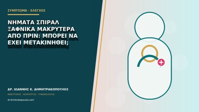 gynaikologika-symptomata-b79-46 Νήματα σπιράλ ξαφνικά μακρύτερα από πριν: μπορεί να έχει μετακινηθεί;