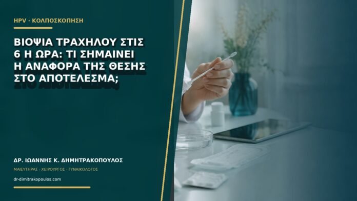 Βιοψία τραχήλου στις 6 η ώρα: τι σημαίνει η αναφορά της θέσης στο αποτέλεσμα;