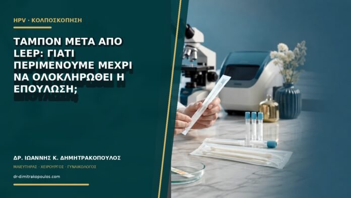 Ταμπόν μετά από LEEP: γιατί περιμένουμε μέχρι να ολοκληρωθεί η επούλωση;