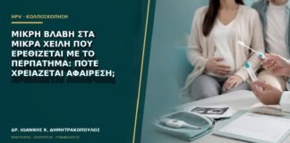 Μικρή βλάβη στα μικρά χείλη που ερεθίζεται με το περπάτημα: πότε χρειάζεται αφαίρεση;