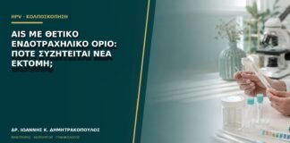 AIS με θετικό ενδοτραχηλικό όριο: πότε συζητείται νέα εκτομή;