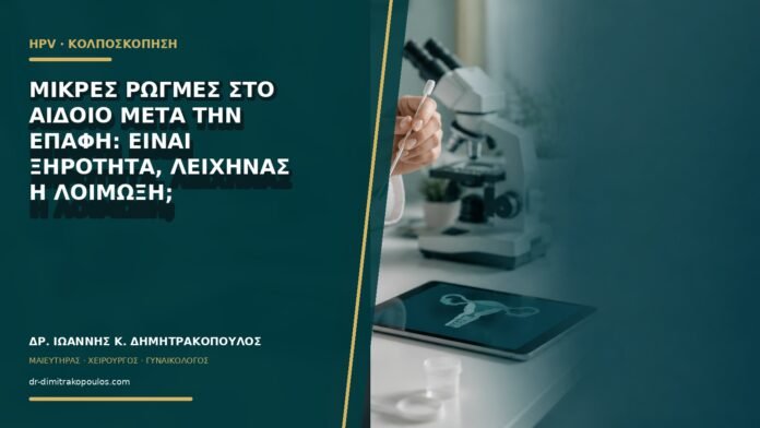 gynaikologikes-ypiresies-b66-20 Μικρές ρωγμές στο αιδοίο μετά την επαφή: είναι ξηρότητα, λειχήνας ή λοίμωξη;
