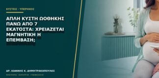 Απλή κύστη ωοθήκης πάνω από 7 εκατοστά: χρειάζεται μαγνητική ή επέμβαση;