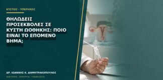 Θηλώδεις προσεκβολές σε κύστη ωοθήκης: ποιο είναι το επόμενο βήμα;