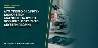 Δύο υπέρηχοι δίνουν διαφορετική διάγνωση για κύστη ωοθήκης: πότε ζητώ δεύτερη γνώμη;