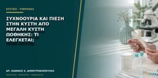 Συχνοουρία και πίεση στην κύστη από μεγάλη κύστη ωοθήκης: τι ελέγχεται;