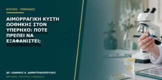Αιμορραγική κύστη ωοθήκης στον υπέρηχο: πότε πρέπει να εξαφανιστεί;