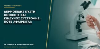 Δερμοειδής κύστη ωοθήκης και κίνδυνος συστροφής: πότε αφαιρείται;
